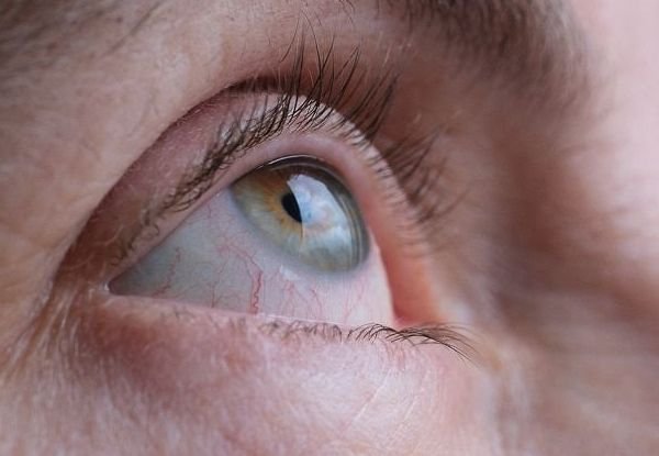 New Non-Surgical Technique Developed to Correct Vision